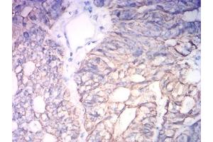 Immunohistochemistry (IHC) image for anti-Keratin 19 (KRT19) (AA 80-400) antibody (ABIN7193468)