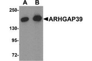 Western blot analysis of ARHGAP39 in A20 cell lysate with ARHGAP39 Antibody  at (A) 1 and (B) 2 μg/ml.
