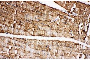 Immunohistochemistry (IHC) image for anti-Voltage-Dependent Anion Channel 1 (VDAC1) (AA 163-178), (Middle Region) antibody (ABIN3044167)