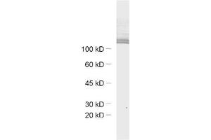 dilution: 1 : 1000, sample: mouse retina extract (Ribeye (AA 95-207) 抗体)