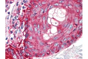Immunohistochemistry staining of human skin (paraffin sections) using anti-CD59 (MEM-43/5). (CD59 抗体)