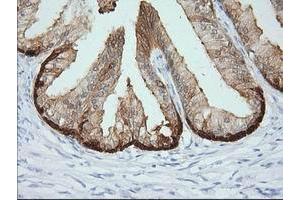 Immunohistochemical staining of paraffin-embedded Human prostate tissue using anti-CRYM mouse monoclonal antibody. (CRYM 抗体)