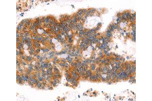 Immunohistochemistry (IHC) image for anti-Afadin (MLLT4) antibody (ABIN2432053) (Afadin 抗体)