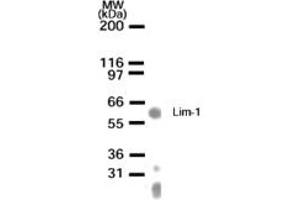 Image no. 1 for anti-LIM Homeobox 1 (LHX1) (AA 149-165) antibody (ABIN233117) (LHX1 抗体  (AA 149-165))