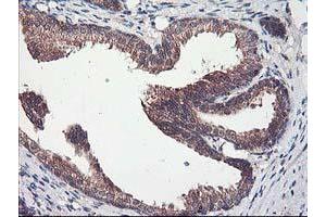 Image no. 1 for anti-Chromosome X Open Reading Frame 26 (CXorf26) antibody (ABIN1497690) (CXorf26 抗体)