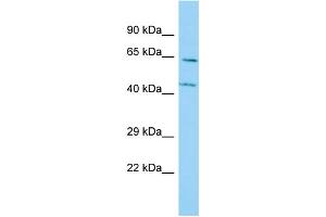 Host: Rabbit Target Name: P4HA3 Sample Type: A549 Whole Cell lysates Antibody Dilution: 1. (P4HA3 抗体  (N-Term))