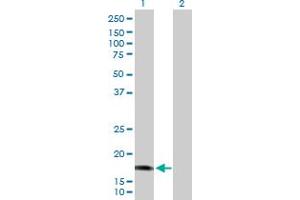 Western Blot analysis of CALML5 expression in transfected 293T cell line by CALML5 MaxPab polyclonal antibody. (CALML5 抗体  (AA 1-146))