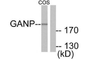 Western blot analysis of extracts from COS7 cells, using MCM3AP Antibody . (GANP 抗体  (C-Term))