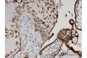 Immunoperoxidase of monoclonal antibody to CSNK1D on formalin-fixed paraffin-embedded human placenta. (Casein Kinase 1 delta 抗体  (AA 301-415))