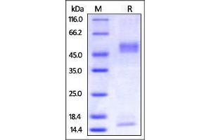 SDS-PAGE (SDS) image for neonatal Fc Receptor (FcRn) (AA 22-297) (Active) protein (His tag,Strep Tag,AVI tag,Biotin) (ABIN2870570)