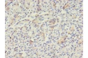 Immunohistochemistry of paraffin-embedded human pancreatic tissue using ABIN7175650 at dilution of 1:100 (VWA5B2 抗体  (AA 781-862))