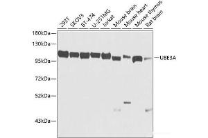 Western blot analysis of extracts of various cell lines using UBE3A Polyclonal Antibody at dilution of 1:1000. (ube3a 抗体)