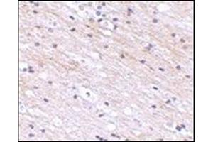 Immunohistochemistry of SATB1 in human brain tissue with this product at 2. (SATB1 抗体  (N-Term))