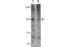 Western blot analysis of NLRP5 in mouse brain tissue lysate with NLRP5 polyclonal antibody  at 1 ug/mL in (1) the absence and (2) the presence of blocking peptide. (NLRP5 抗体  (C-Term))