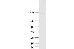 Western Blotting (WB) image for FIG4 Homolog, SAC1 Lipid Phosphatase Domain Containing (FIG4) protein (Myc-DYKDDDDK Tag) (ABIN2731347)