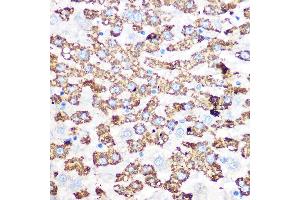 Immunohistochemistry of paraffin-embedded rat liver using GLUD1 Rabbit mAb (ABIN7267411) at dilution of 1:100 (40x lens). (GLUD1 抗体)