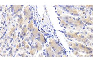 Detection of Slit3 in Mouse Stomach Tissue using Polyclonal Antibody to Slit Homolog 3 (Slit3) (SLIT3 抗体  (AA 454-498))
