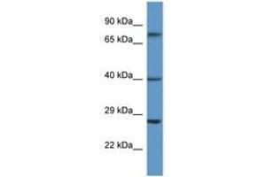Image no. 1 for anti-Angiotensin II Receptor, Type 2 (AGTR2) (N-Term) antibody (ABIN6746732)