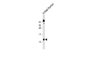 Anti-AHSP Antibody (Center) at 1:1000 dilution + human fetal thymus lysate Lysates/proteins at 20 μg per lane. (aHSP 抗体  (AA 39-73))