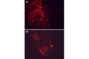 Immunofluorescence staining of mouse colon (A) and human colon cancer (B) with HSP90B1 monoclonal antibody, clone H9010  at 100,000 fold dilution.