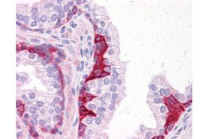 Anti-PIAS3 antibody IHC of human prostate. (PIAS3 抗体  (C-Term))