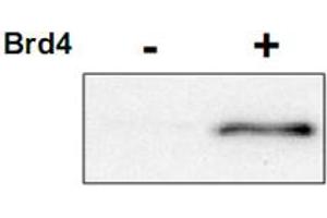 Western blot using CDK9 (phospho T29) polyclonal antibody  shows detection of phospho-CDK9. (CDK9 抗体  (pThr29))