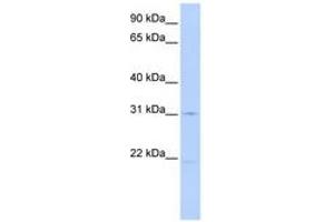 Image no. 1 for anti-Solute Carrier Family 25 (Mitochondrial Oxodicarboxylate Carrier), Member 21 (Slc25a21) (AA 72-121) antibody (ABIN6740856) (SLC25A21 抗体  (AA 72-121))