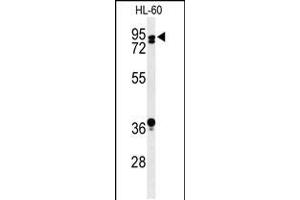 Western blot analysis of PATL1 Antibody in HL-60 cell line lysates (35ug/lane) (PATL1 抗体  (C-Term))