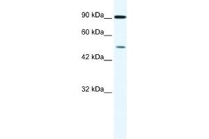 WB Suggested Anti-ZNF175 Antibody Titration:  0. (ZNF175 抗体  (N-Term))