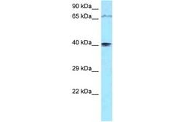 PIP5KL1 Antikörper  (AA 254-303)
