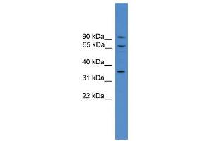 WB Suggested Anti-CCIN Antibody Titration: 0. (Calicin 抗体  (N-Term))