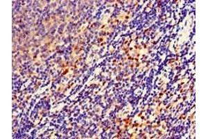 Immunohistochemistry of paraffin-embedded human lymph node tissue using ABIN7152706 at dilution of 1:100 (FERMT3 抗体  (AA 388-503))