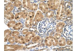 Immunohistochemistry (IHC) image for anti-Prostaglandin D2 Synthase (PTGDS) (N-Term) antibody (ABIN2783248) (PTGDS 抗体  (N-Term))