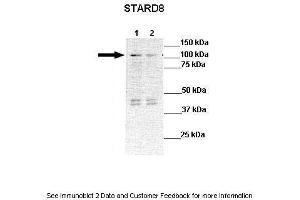 Lanes:  Lane 1: 30ug STARD8 transfected HEK293T lysate Lane 2: 30ug HEK293T lysate  Primary Antibody Dilution:  1:1000 Secondary Antibody:  Anti-rabbit-HRP Anti-rabbit-HRP Secondary Antibody Dilution:  1:10,000 Gene Name:  STARD8 Submitted by:  Dr Frankie Ko Chi Fat, Lo-Kong Chan, Irene O. (STARD8 抗体  (N-Term))