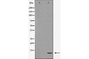 Western blot analysis of Interleukin 8 expression in HeLa cells,,The lane on the left is treated with the antigen-specific peptide. (IL-8 抗体  (Internal Region))