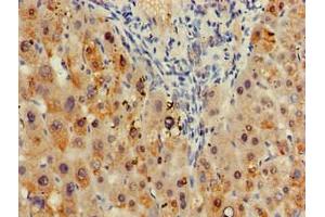 Immunohistochemistry of paraffin-embedded human liver tissue using ABIN7171273 at dilution of 1:100 (SDCBP 抗体  (AA 21-228))