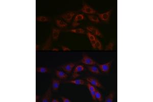 Immunofluorescence analysis of NIH/3T3 cells using  Rabbit pAb (ABIN6129847, ABIN6136332, ABIN6136333 and ABIN6223063) at dilution of 1:100 (40x lens). (ABCA1 抗体  (AA 1870-2120))