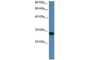 Western Blot showing Ccdc90b antibody used at a concentration of 1. (CCDC90B 抗体  (N-Term))