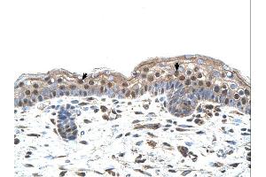 Immunohistochemistry (IHC) image for anti-Interferon Regulatory Factor 4 (IRF4) (N-Term) antibody (ABIN2780428) (IRF4 抗体  (N-Term))