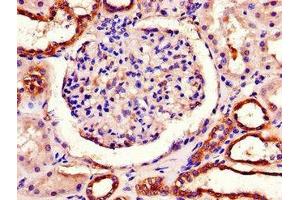 Immunohistochemistry of paraffin-embedded human kidney tissue using ABIN7163469 at dilution of 1:100 (PITX3 抗体  (AA 10-200))