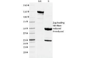 SDS-PAGE Analysis Purified DNMT1 Mouse Monoclonal Antibody (DNMT1/2061). (DNMT1 抗体  (AA 767-912))