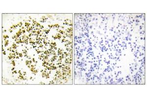 Immunohistochemistry analysis of paraffin-embedded human lymph node tissue using Musculin antibody. (Musculin 抗体  (C-Term))