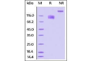Biotinylated Human IL-17 RA, Fc Tag on SDS-PAGE under reducing (R) and no-reducing (NR) conditions. (IL17RA Protein (AA 33-320) (Fc Tag,AVI tag,Biotin))