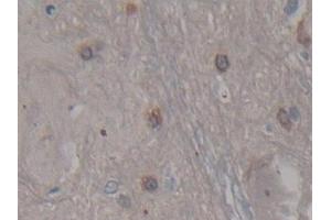 Detection of CDNF in Rat Spinal cord Tissue using Polyclonal Antibody to Cerebral Dopamine Neurotrophic Factor (CDNF) (CDNF 抗体  (AA 20-183))