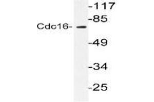 Western blot analysis of CDC16 in extracts from HuvEc cells using CDC16 / APC6 antibody (CDC16 抗体)