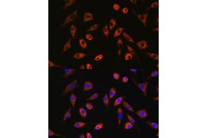 Immunofluorescence analysis of L929 cells using TP53I13 antibody (ABIN7271098) at dilution of 1:100. (TP53I13 抗体  (AA 180-310))