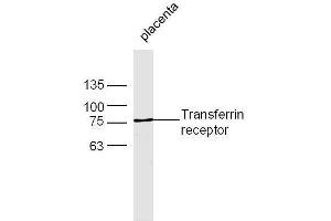 Mouse placenta lysates probed with Rabbit Anti-Transferrin receptor Polyclonal Antibody, Unconjugated  at 1:500 for 90 min at 37˚C (Transferrin Receptor 抗体  (AA 621-720))