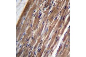 Immunohistochemistry analysis in formalin fixed and paraffin embedded human heart tissue reacted with FBLIM1 Antibody (C-term) followed by peroxidase conjugation of the secondary antibody and DAB staining. (FBLIM1 抗体  (C-Term))