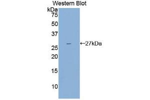 Western blot analysis of the recombinant protein. (IL2 Receptor beta 抗体  (AA 27-239))