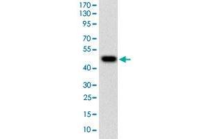 Western blot analysis of human TUBE1 (AA: 314-472) recombinant protein (Expected MW is 44. (TUBE1 抗体  (AA 314-472))